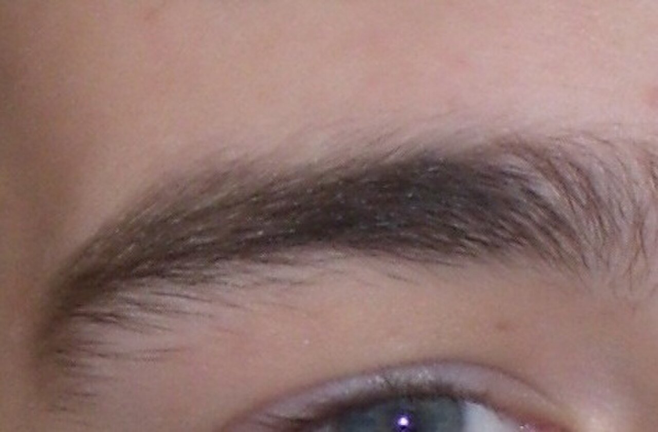 Eyebrow Transplant in Turkey