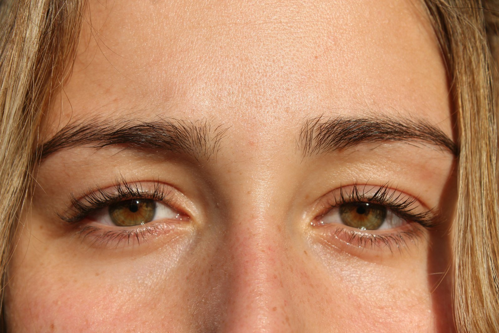 Why Choose Eyebrow Transplant in Turkey?
