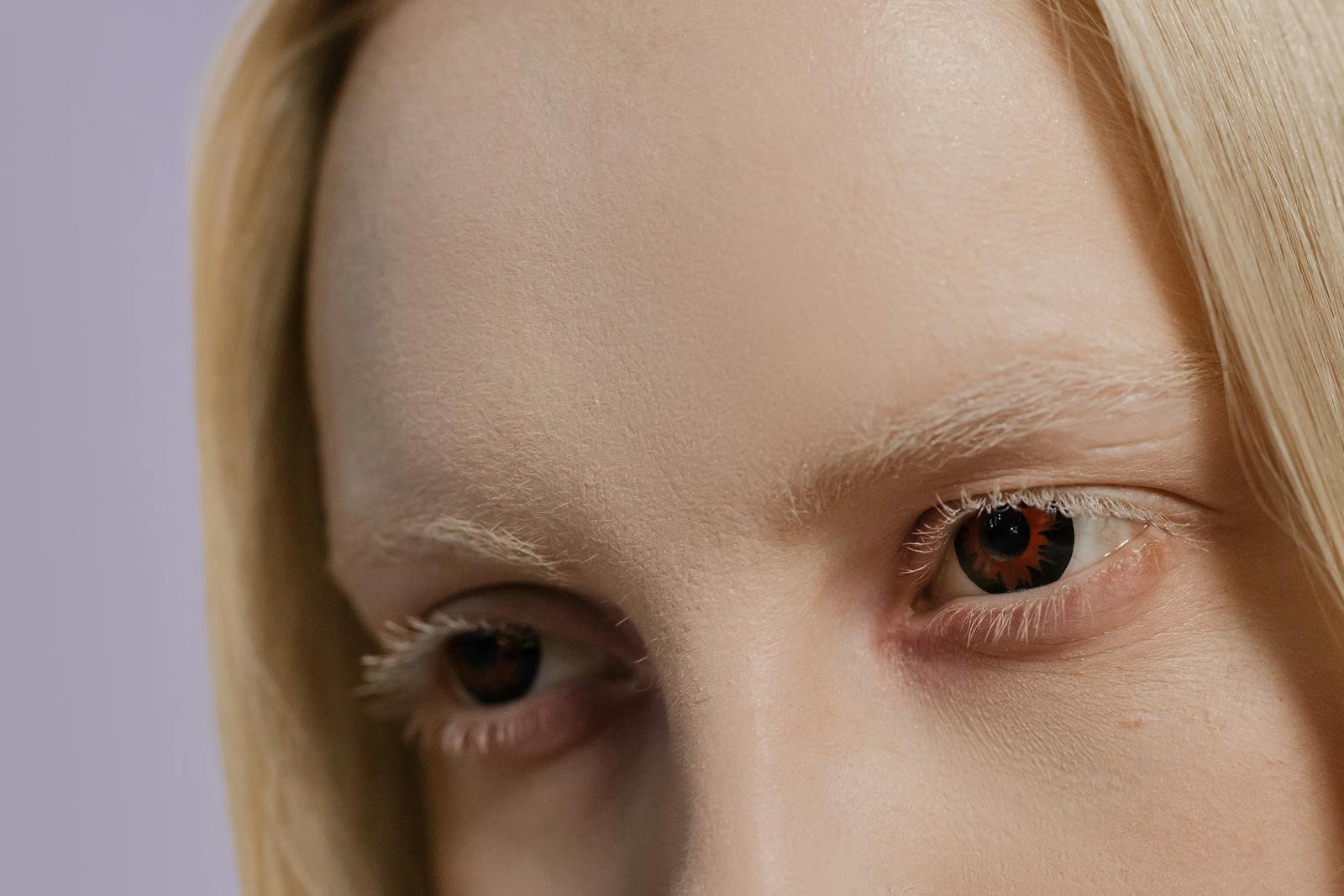 Am I Suitable for an Eyebrow Transplant?