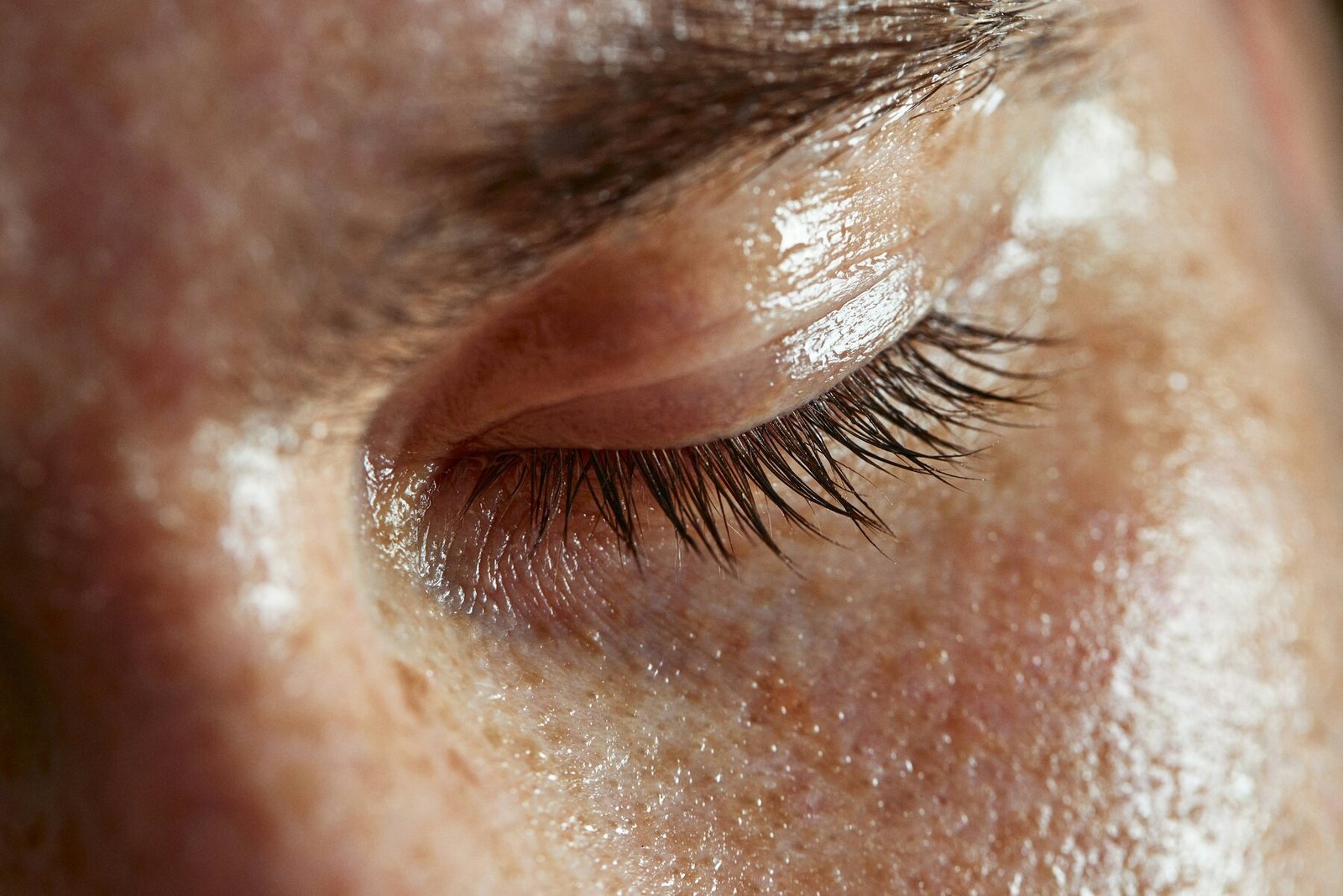 Why Choose Yüzyıl Hospital for Eyelid Surgery in Turkey?