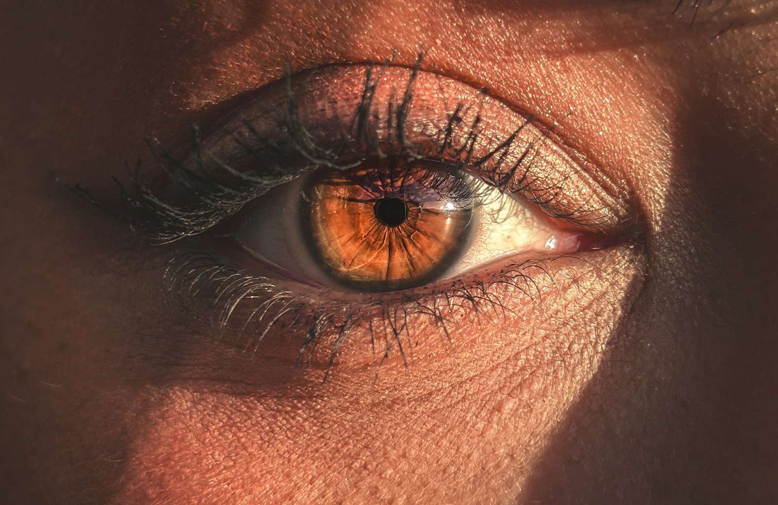 Eyelid Surgery in Turkey