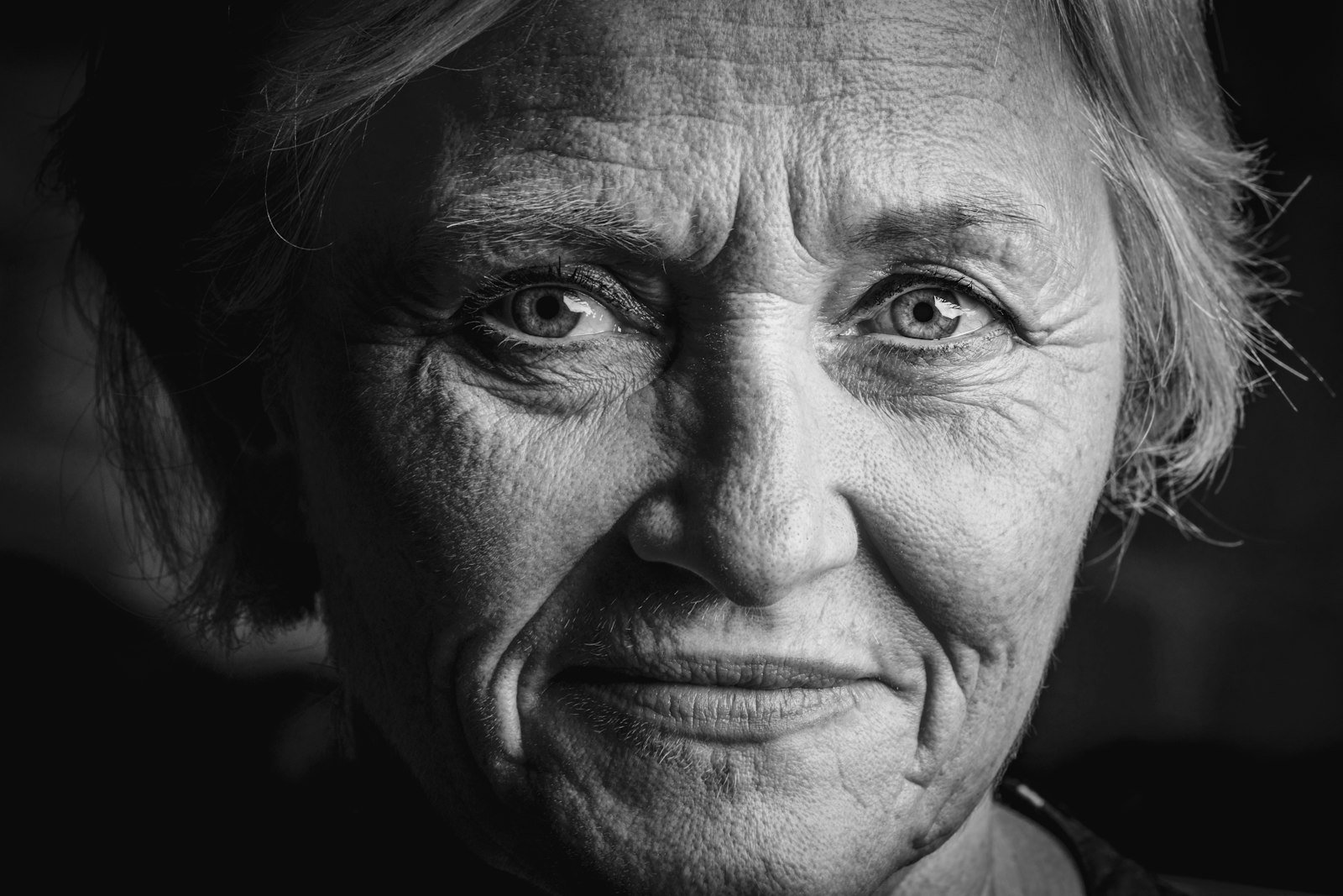Why Choose Face Lift Surgery in Turkey?
