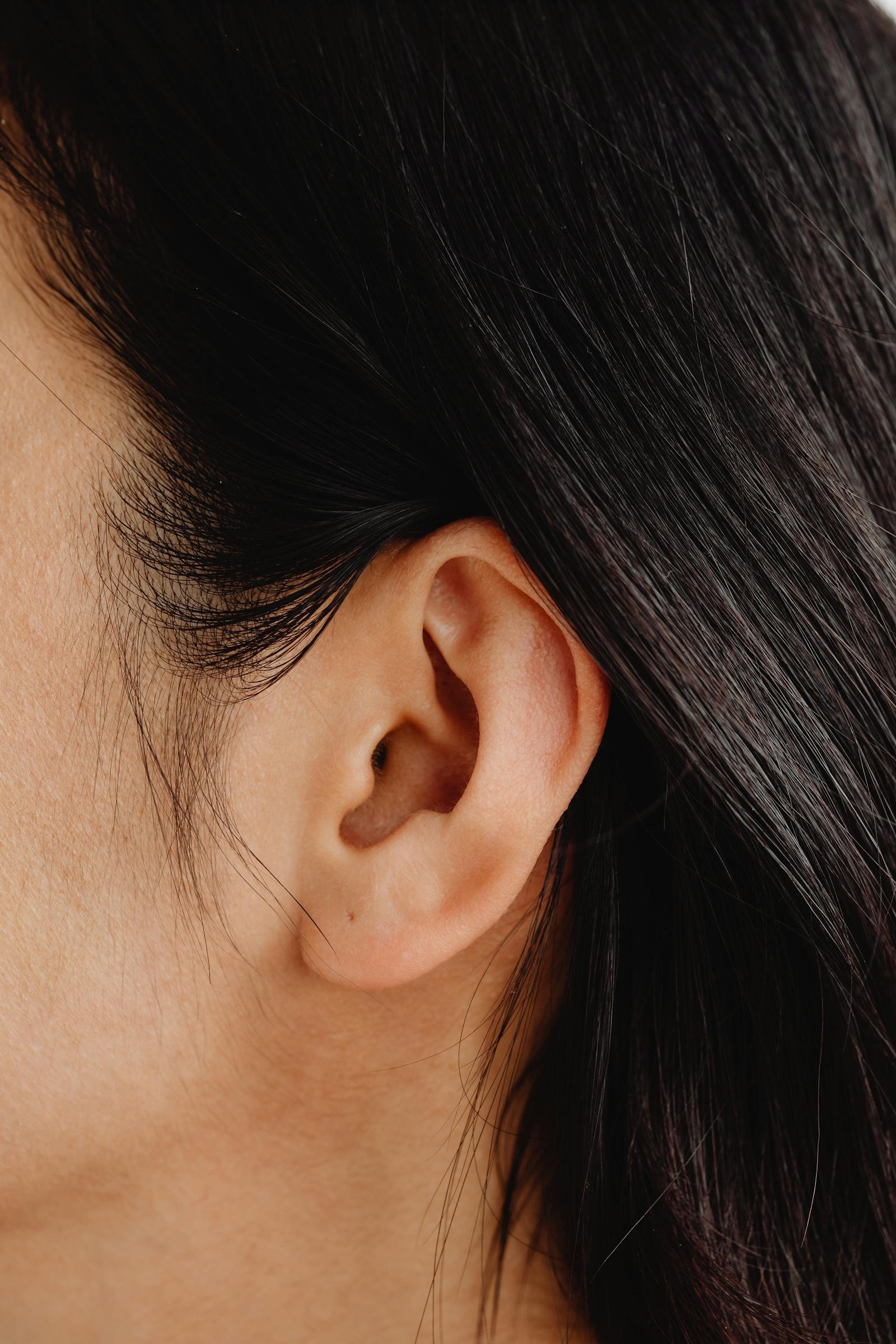 Why Choose Otoplasty in Turkey?