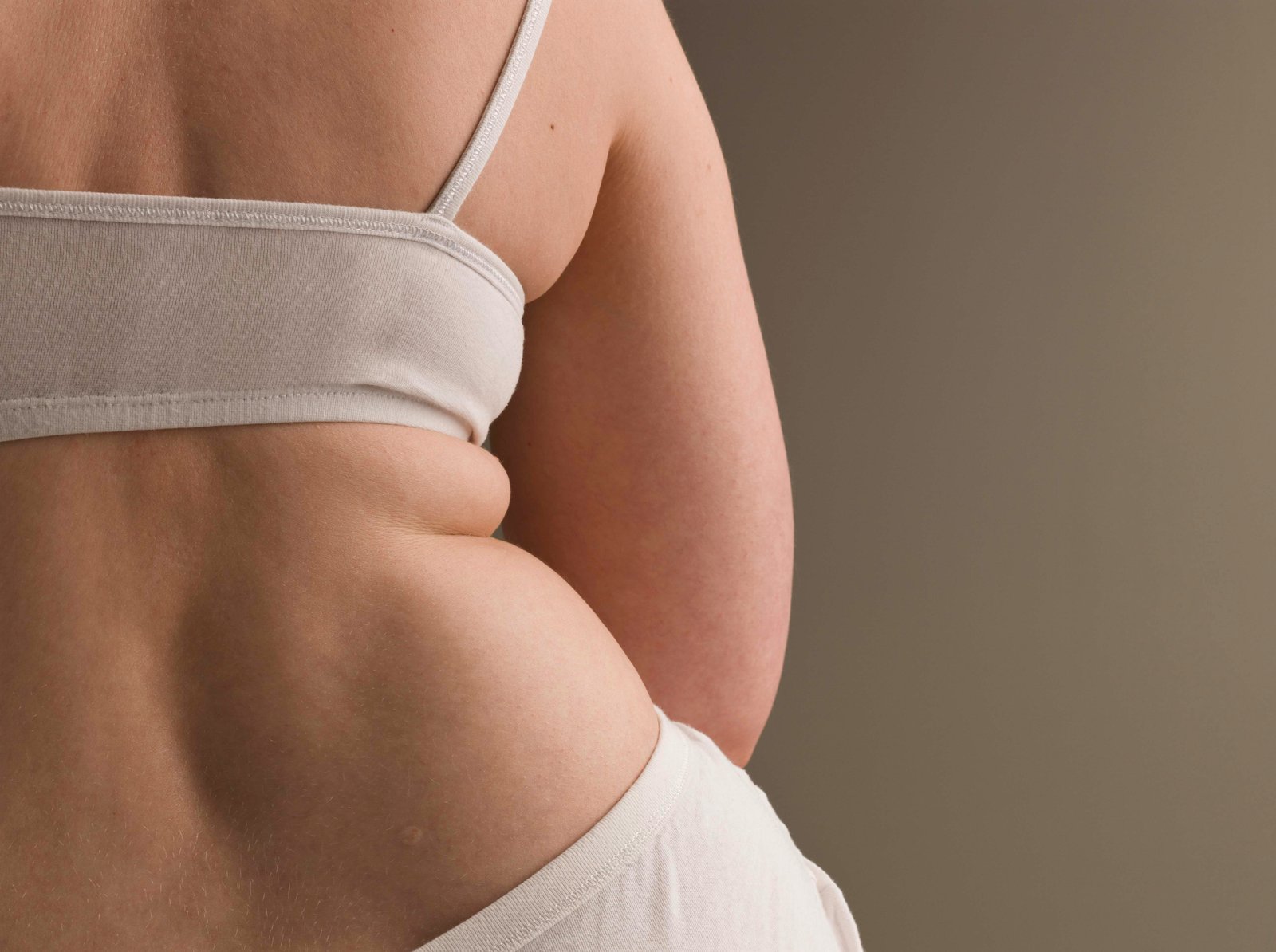 Tummy Tuck Before and After Results