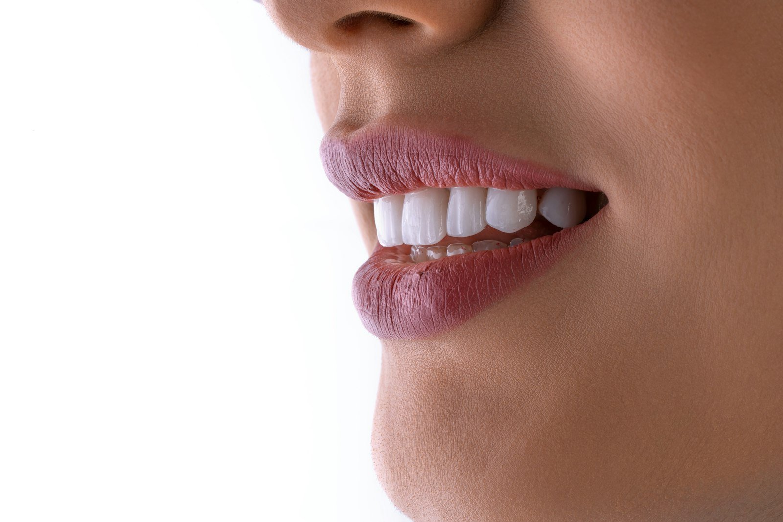 Dental Veneers in Turkey