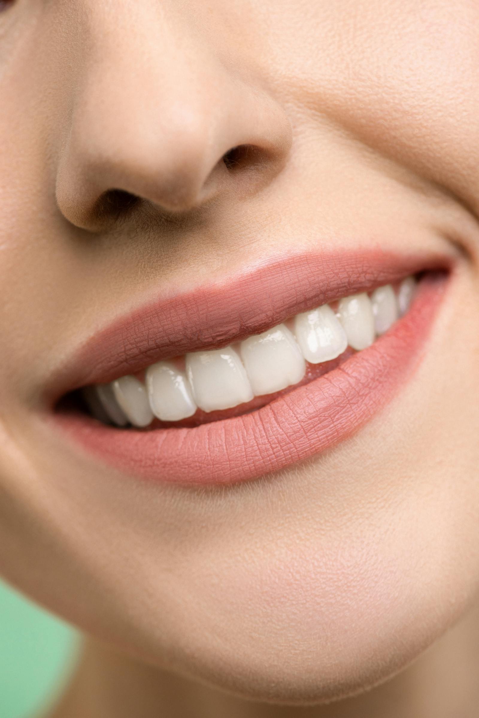 Dental Veneers in Turkey